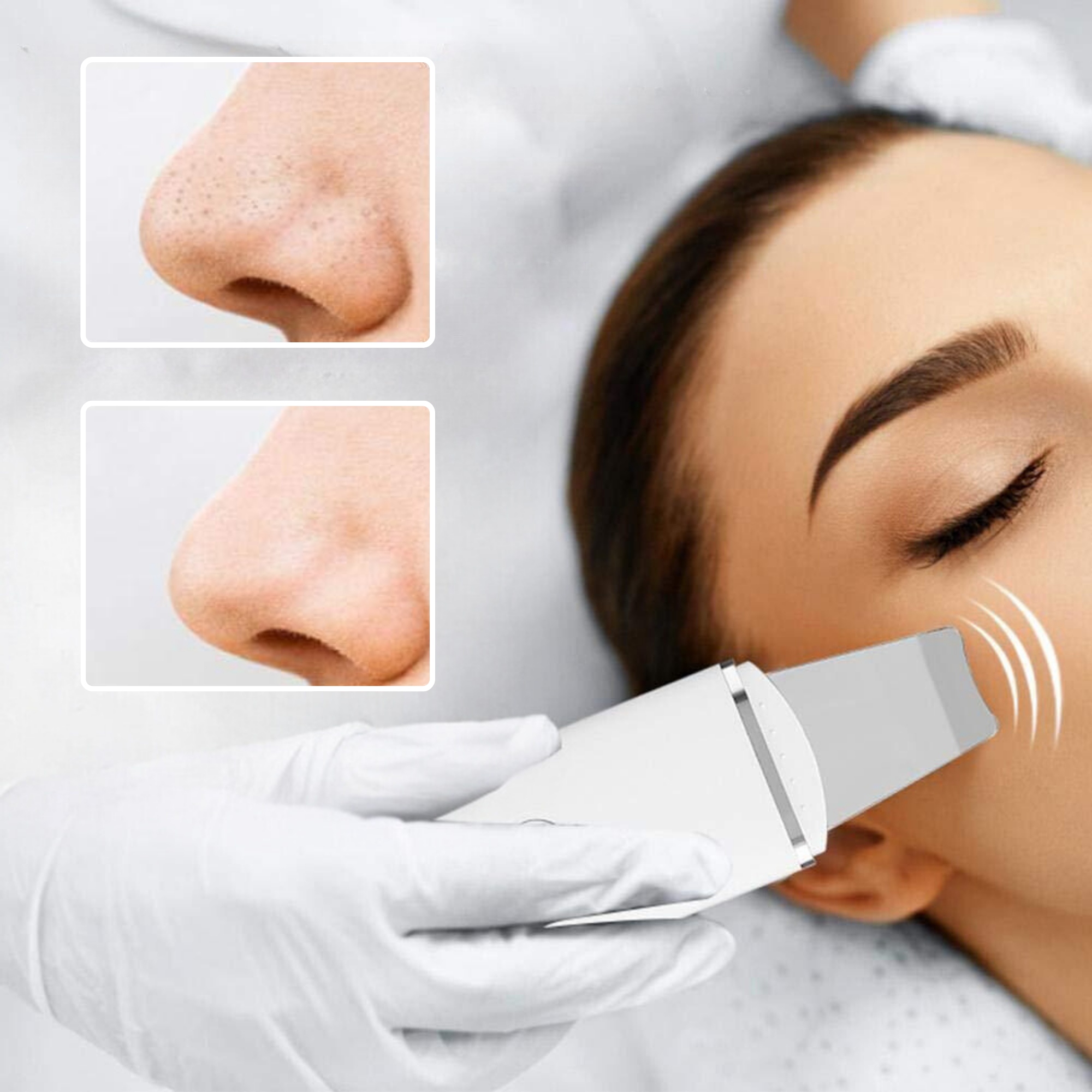 Spatule Ultrasonique Peeling & Lifting - EclatBel